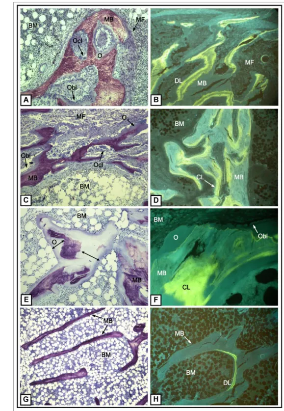 Figura 1. Microfotografias representativas de osso sub-calcificado exibindo diferentes tipos de osteodistrofia renal