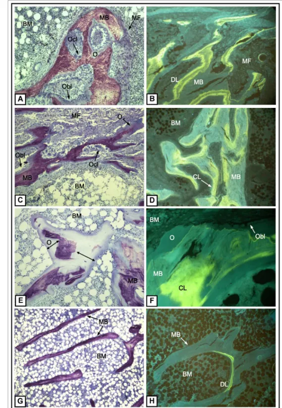Figure 1. Representative photomicrographs of under-calcified bone showing different types of renal osteodystrophy