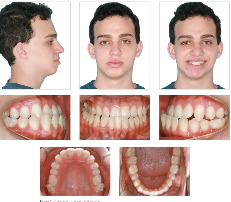 Figure 2 - Initial panoramic radiograph.