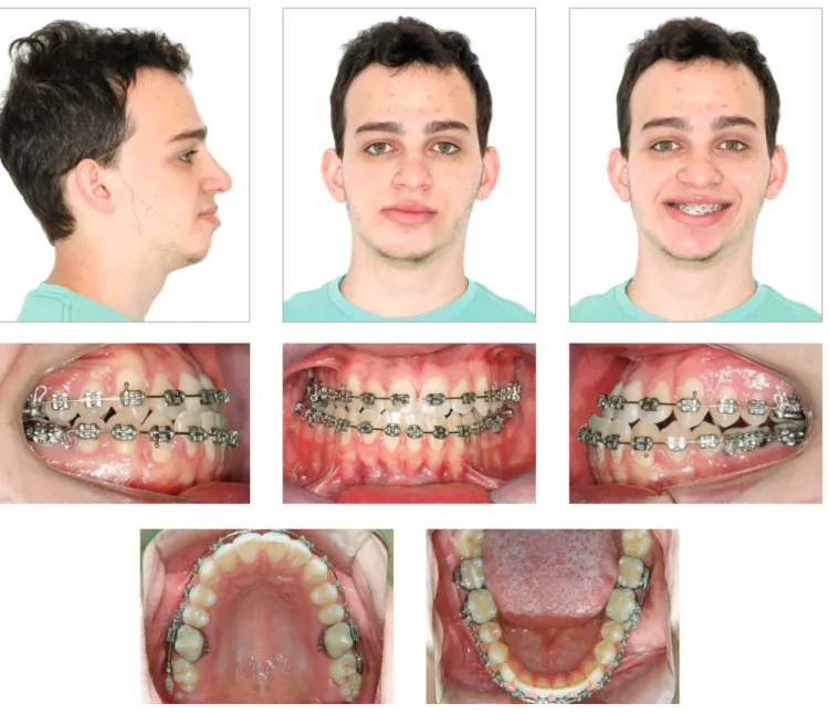 Figure 5 - Intermediate panoramic radiograph.
