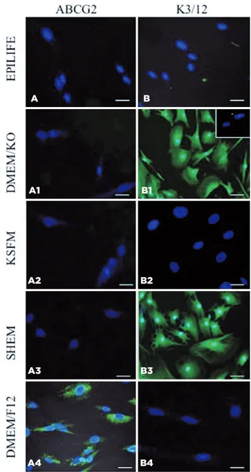 Figure 2. LSC and corneal cell protein expression in hIDPSCs grown for  7 days in different culture media on a plastic substrate