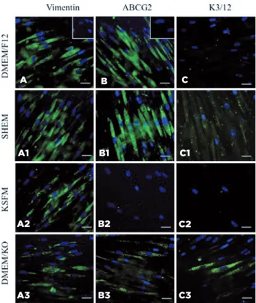 Figure 3. LSC and corneal cell marker expression in hIDPSCs grown on  AM over 7 days in different culture media