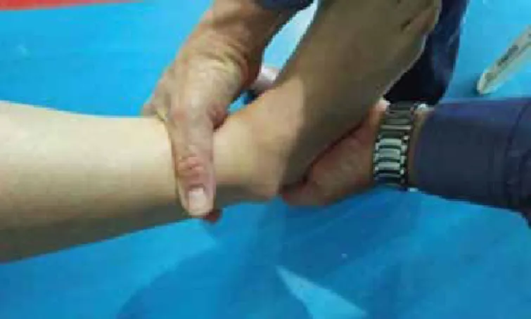 Figure 1. Negative anterior drawer test.