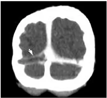 Figura 1. Baseline head CT scan (Electronic Patient Chart).
