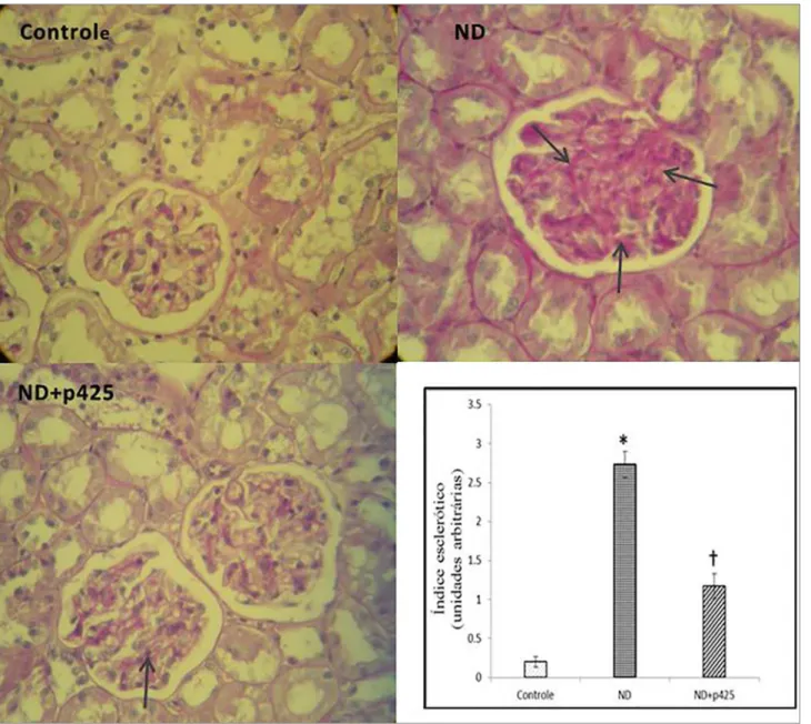 Figura 4. Fotomicrografias de tecidos renais corados pelo método PAS. ND: Nefropatia Diabética; p425: antagonista do MIF