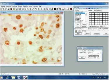 FIGURE  − Image of screen capture of Image Pro Plus 6.0 software with the file of cells  brown stained with Ki-67 antibody