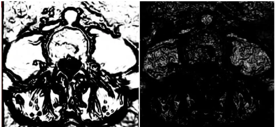 Figure 3.8: Left image was obtained with the parameters α = −1.0 and β = 10.0. Right image was obtained with the parameters α = −1.0 and β = 0.0 .