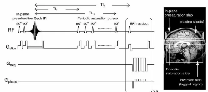Figure  4.3:  Pulse  sequence  used  for  Q2TIPS  ASL  imaging.  On  the  right  the  locations  of  the  in-plane  pre-saturation  slab,  imaging slice(s), periodic saturation slice, and inversion slab used in the PICORE labelling scheme are shown [38]