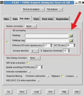 Figure 4.4: Layout of GUI interface for FUGUE (part of FEAT), for applying EPI distortion correction