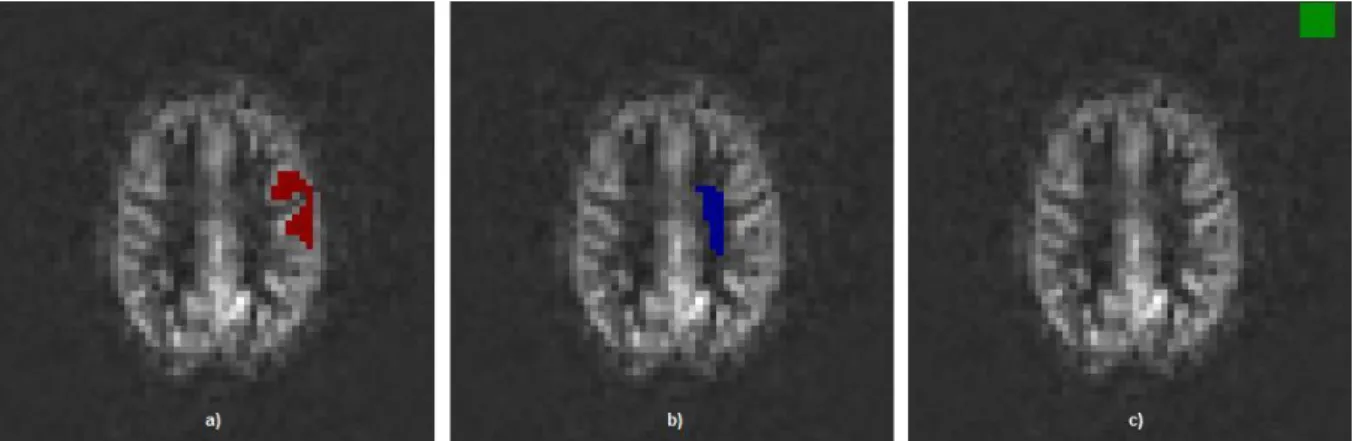 Figure 4.7: Manually prescribed example ROIs for GM and WM SNR estimation: a) GM signal ROI, b) WM signal ROI and c)  noise ROI
