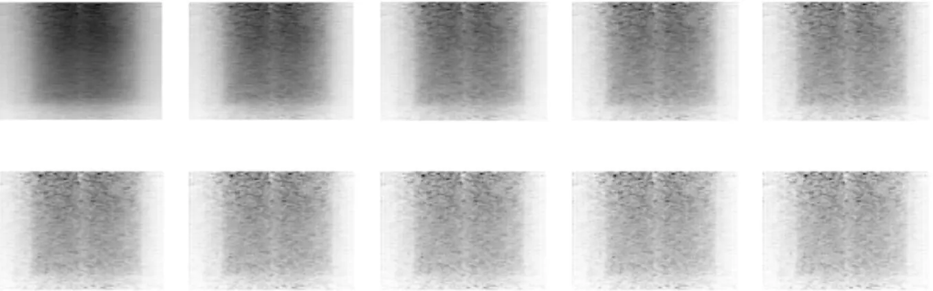 Figure 5.8: Images reconstructed with OS-EM 2D from the 1 st  to the 10 th  iteration, with the same sensitivity  correction threshold