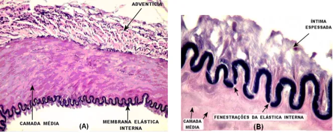 Figura 1.6 – Corte transversal de artéria Temporal com coloração Verhoeff para evidenciar as fibras elásticas