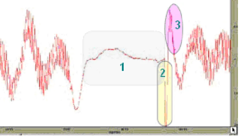 Figura 2.17 – Variação da Pressão arterial na reacção de Hiperemia Reactiva.