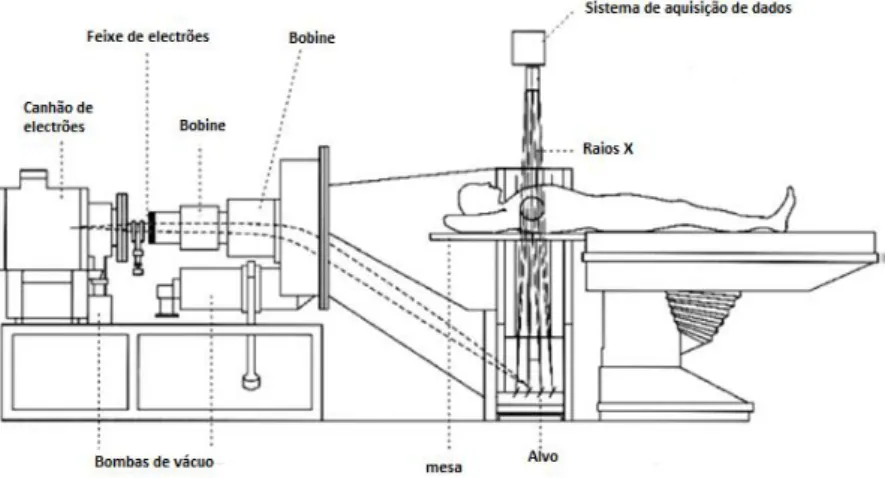 Fig. 2.10 - Representação esquemática de uma máquina de TC de 5ª geração [25] 