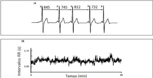 Figura 1.1: Exemplo da identificação dos intervalos RR (1B) a partir de um ECG (1A).