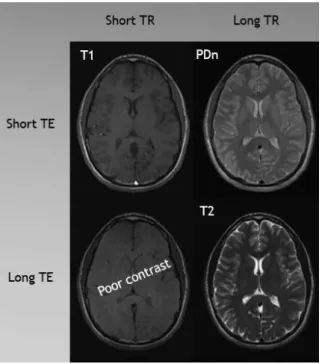 Figure 2.5: Inﬂuence of parameters TE and TR on the resulting weighted images. Adapted from [5].