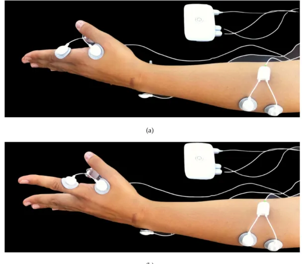Figure 3.2: Ipsilateral acquisitions experimental setup: Bioplux research device, placement of two EMG sensors and ground