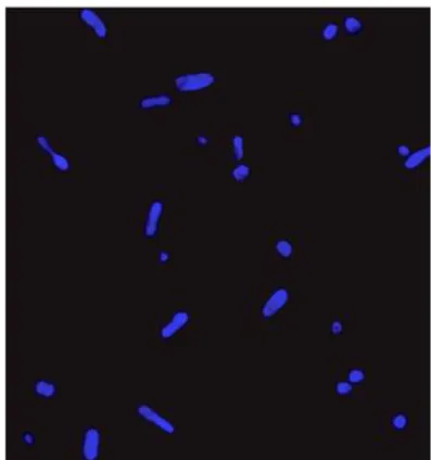 Figure 2.1:  Example of an image created by ‘SIMCEP’. Adapted from  [15] 