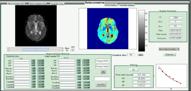 Figura 4.4 – Ilustração da interface em MatLab para a marcação das ROI no GP com uma aplicação num  sujeito em estudo