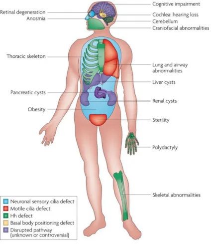 Figure 1.6 - Organs affected in human Ciliopathies. Numerous pleiotropic human disorders have been attributed to defects  in  cilia  formation