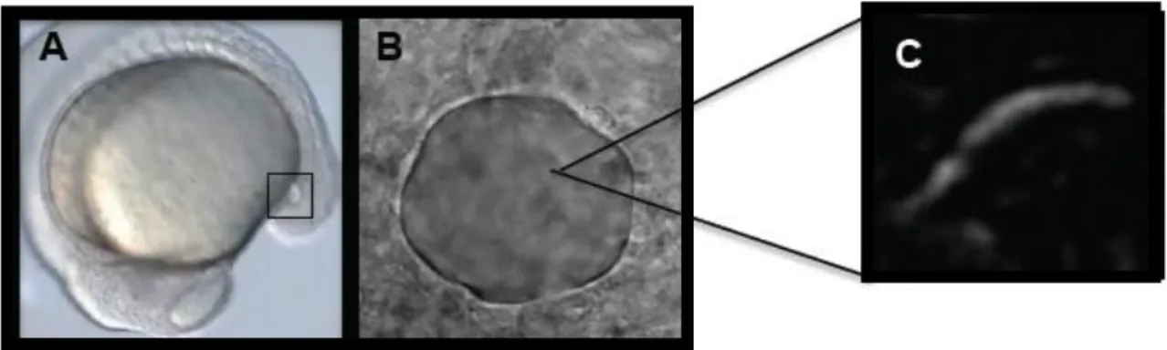 Figure  1.12  –  Images  of zebrafish  KV  and  cilium.  A  -  Localization  of  the KV  (squared  region)  in the  body  of  the  zebrafish  embryo at 14 hpf