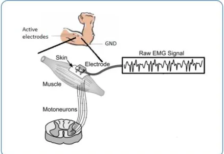 Figure 2.6: Surface EMG: after the action potential goes through the motorneuron and the muscle, it is collected by active electrodes at the skin’s surface