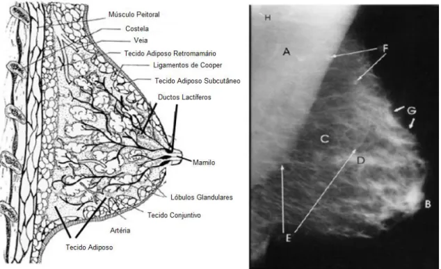 Figura  2.1  -  Esquerda:  Vista  lateral  esquemática  da  mama.  Direita:  Padrão  de  densidades das estruturas anatómicas da mama: (A) músculo peitoral, (B) mamilo, (C)  tecido  adiposo,  (D)  tecido  glandular,  (E)  veias,  (F)  nodos  linfáticos,  (