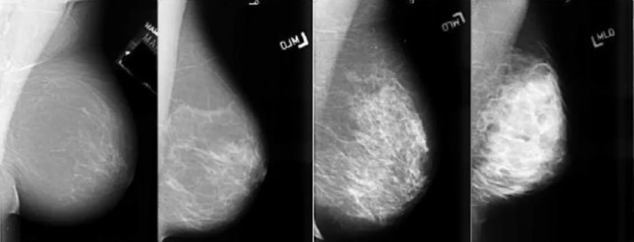 Figura  2.2  -  Mamografias  demonstrativas  das  categorias  de  densidade  mamária,  em  evolução, da esquerda para a direita, da categoria I à categoria IV [34] 
