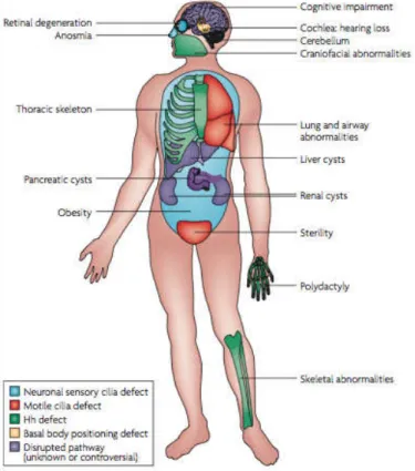 Figure 1.6  - Organs affected in human Ciliopathies. Numerous pleiotropic human disorders have been attributed to defects  in  cilia  formation