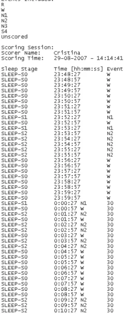 Figura 2-2- Exemplo de de um hiponograma em fomato.txt  exportado do programa RemLogic v