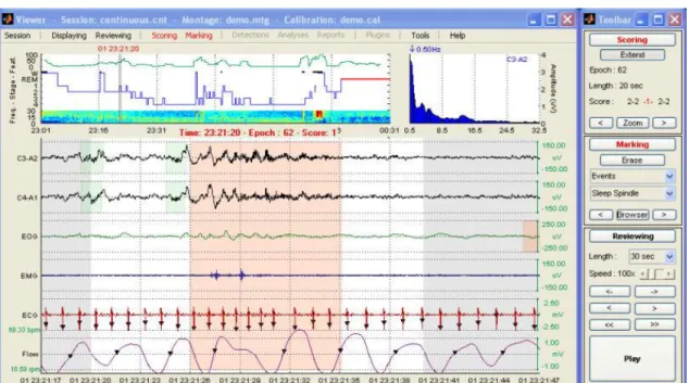 Figura 4.1 – Software Prana