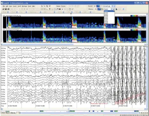 Figura 4.4  –  Software Insight  