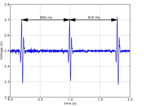 Figure 2.3: Two RR measurements between three consecutive heart beats.