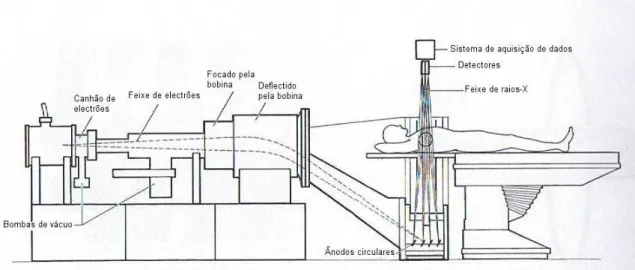 Figura 2.15: Esquema de uma TC de 5.ª geração - Scanner ultra-rápido ou de feixe de electrões [1]