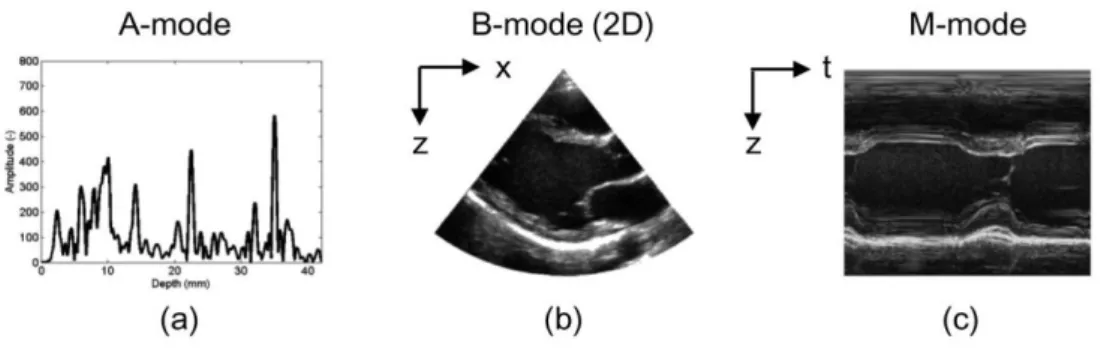 Figure 2.8 - Some of the different types of US acquisition modes: (a) A-mode, a single echo line; 