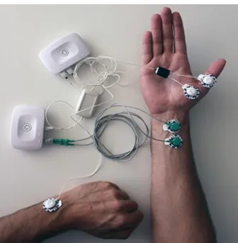 Figure 3.4: Electrostimulator and EMG acquisition units. The electrostimulation unit on top connected with  the acquisition device with the EMG sensor on bottom