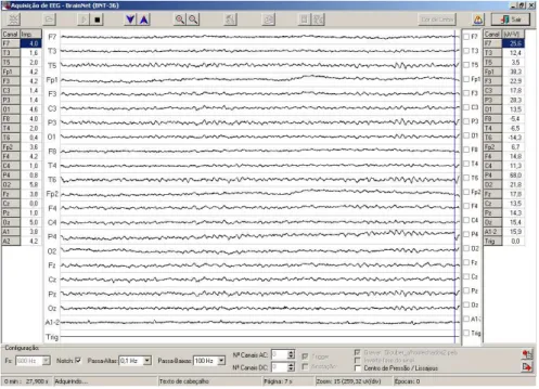 Figura 4.2. Janela do software de aquisição de sinal de EEG com configuração de  filtragem e frequência de amostragem (Fs) e derivações colectadas