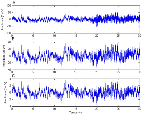 Figura 4.3. Trecho de sinal EEG da derivação P3 do sujeito #9 durante o anúncio C. A) sinal original, B)  sinal após decimação e filtragem e C) B) sinal após normalização