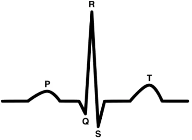 Figure 2.1: ECG basic waveform. This consists on a P wave, a QRS complex, a T wave and a U wave (not represented)