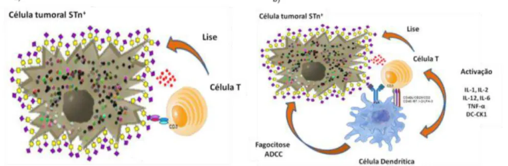 Figura 1.8 Imagem representativa da ligação do anticorpo biespecífico (a) e anticorpo biespecífico trifuncional (b)  entre uma célula tumoral STn +  e células efectoras