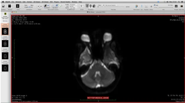 Figure 3.2:  The ViewerController, containing basic image manipulation tools (def- (def-inition of ROIs (region of interest), contrast adjustment, etc.) and the DCMView object