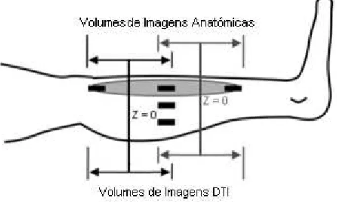 Figura 4.4 – Ilustração exemplificativa do esquema de aquisição das imagens DP + DTI. Adaptado de (Lansdown  et al., 2007) 