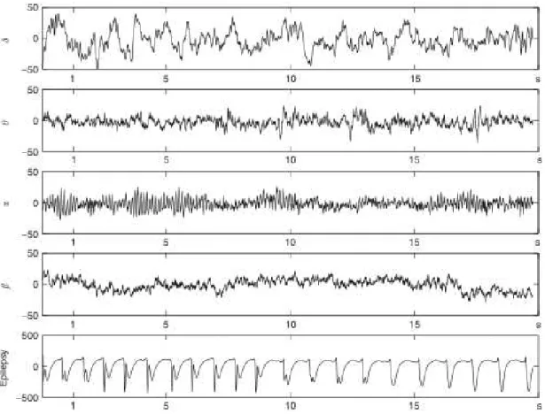 Figure 2-3: Characteristic EEG rhythms. From top to bottom: delta rhythm, theta rhythm, alpha  rhythm, beta rhythm and during an epileptic seizure (note that the amplitude scale of the last signal is an 