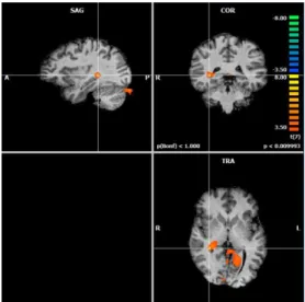 Figure  3.6:  RFX  results.  Relevant  Recruitment  of  primary  visual  cortex  (BA 17)  for  Past Condition > 