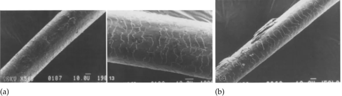 Figura 4.2: a)Padrão da cutícula saudável desenvolvida de um folículo de cabelo humano (Bencze, 1990); b Micróscopia electrónica de varrimento de um cabelo com toxicação por antimónio Sb(Bencze, 1990)