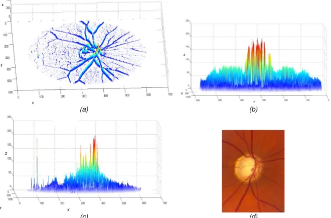 Figura 3.6: Cálculo da região de interesse para segmentação do Disco Óptico. (a) Resultado da aplicação do  filtro  de  Sobel  à  rede  vascular  da  retina;  (b)  Perfil  horizontal;  (c)  Perfil  vertical;  (d)  Exemplo  de  região  de  interesse