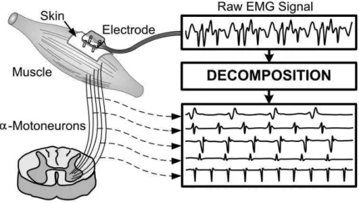 Figure 2.4: Surface EMG recording. Adapted from [4].