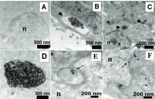 Figura 1.9: Imagens obtidas por TEM nas quais se observa a biodistribuição das NPs em células cancerígenas