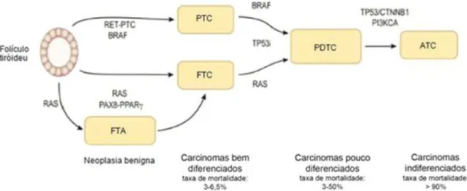 Figura I.6  –  Modelo de progressão dos carcinomas derivados do epitélio folicular e taxa de mortalidade associada a cada tipo  de tumor (adaptado de Clark e Faquin, 2010; Sastre-Perona e Santisteban, 2012) 