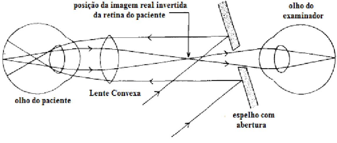 Figura 1.10- Princípio do Oftalmoscópio Indirecto (Crick &amp; Khaw 2003)